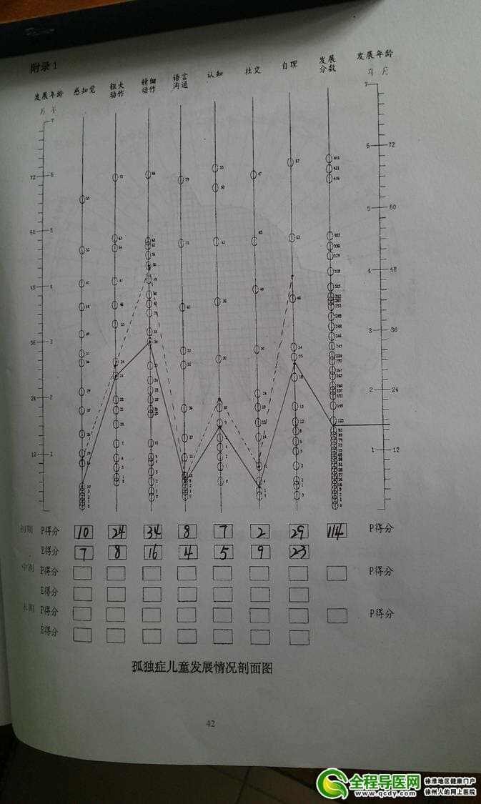 孤独症儿童发展情况剖面图1
